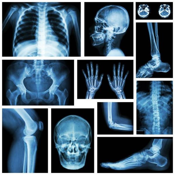 🎉 Retour sur la soirée thématique "Imagerie et Parcours de soins" – CPTS SQY 🎉