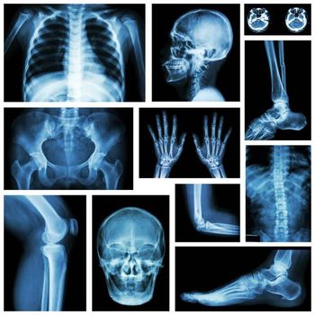 🎉 Retour sur la soirée thématique "Imagerie et Parcours de soins" – CPTS SQY 🎉